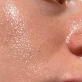 Xác định các loại da và cách chăm sóc